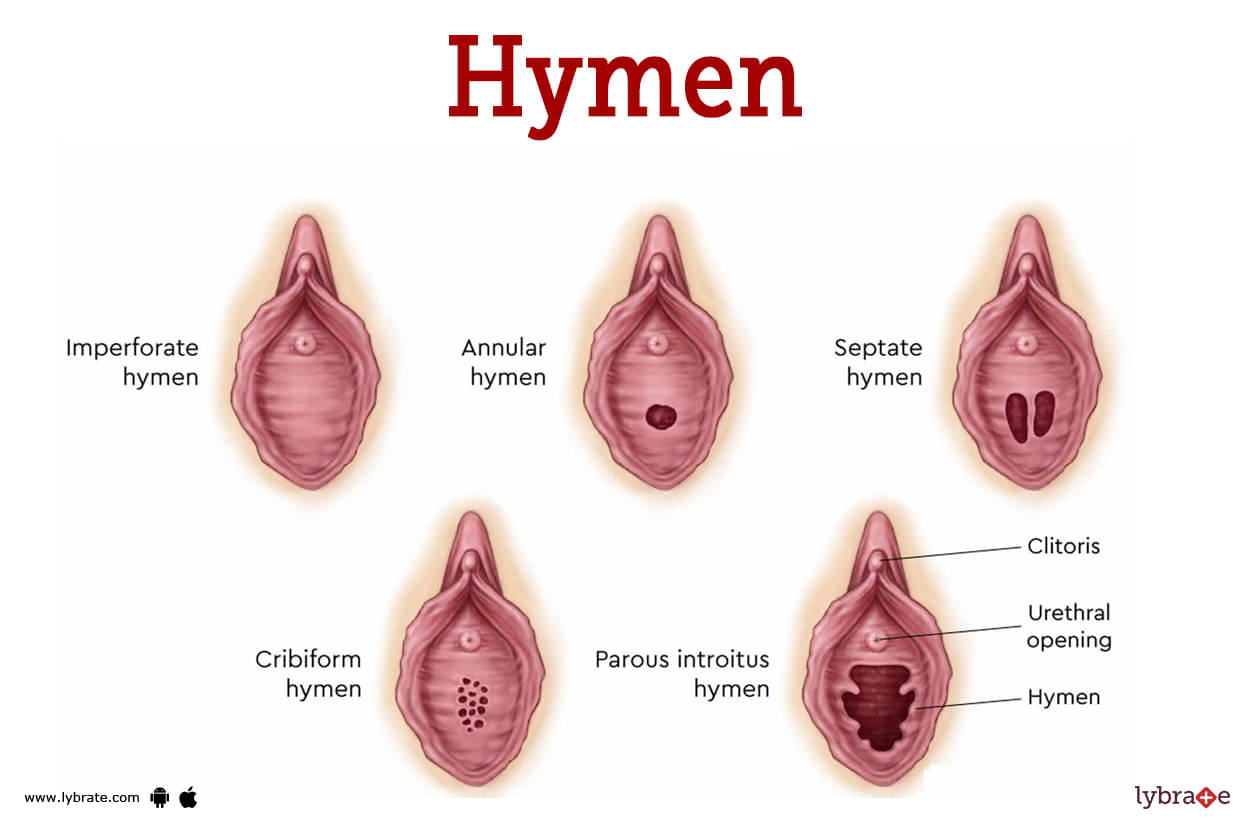 Virgin hymen pictures