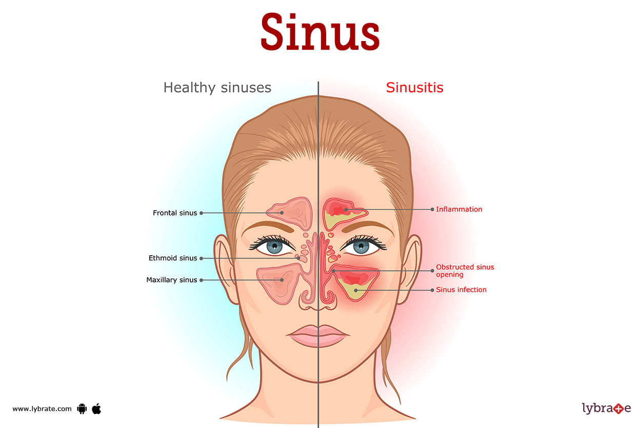 Sinus (Human Anatomy): Picture, Functions, Diseases, and Treatments