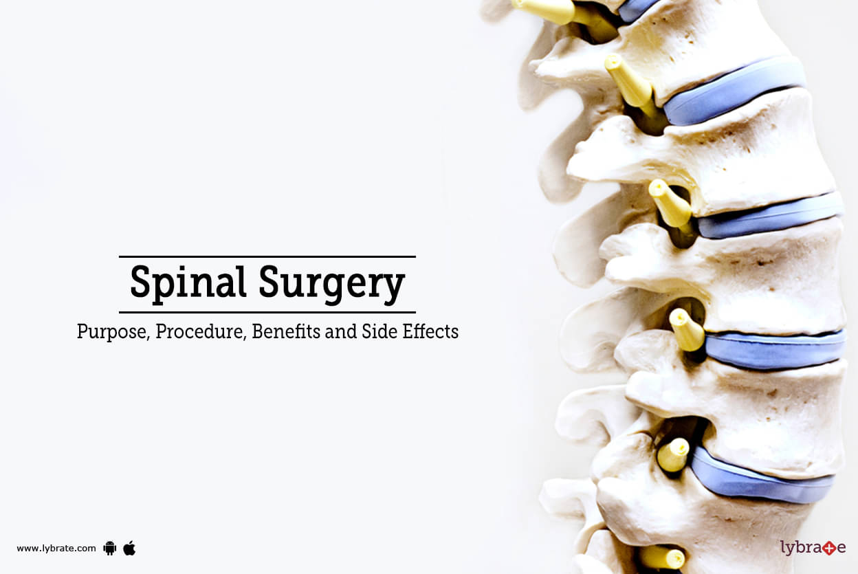 Spinal Surgery: Types, Recovery, Risks, and Benefits