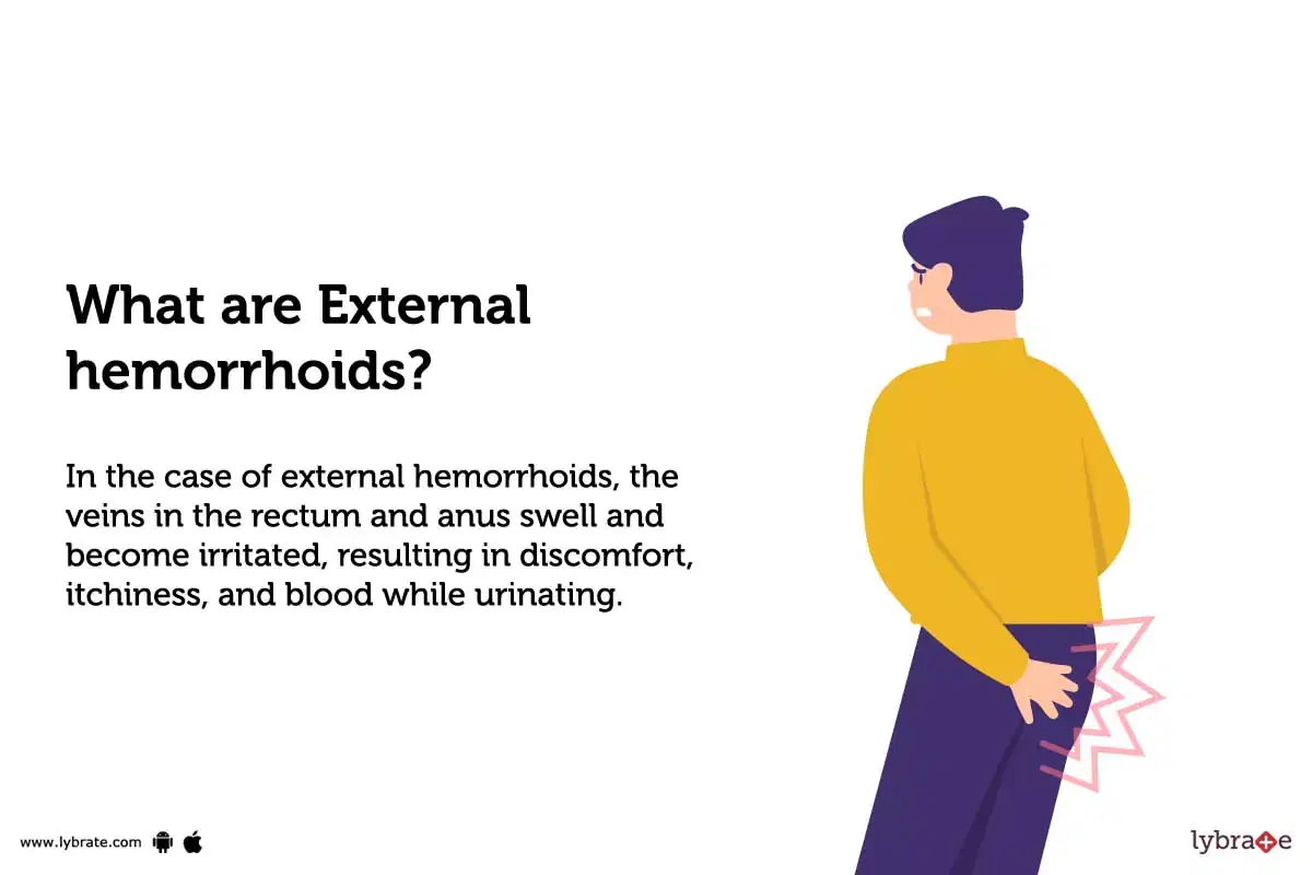 hemorrhoids-symptoms