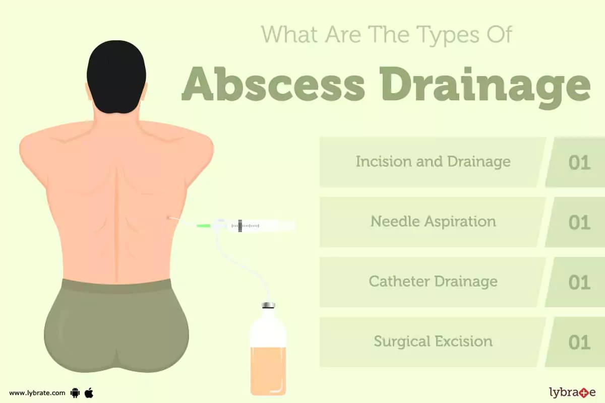 skin abscess drain