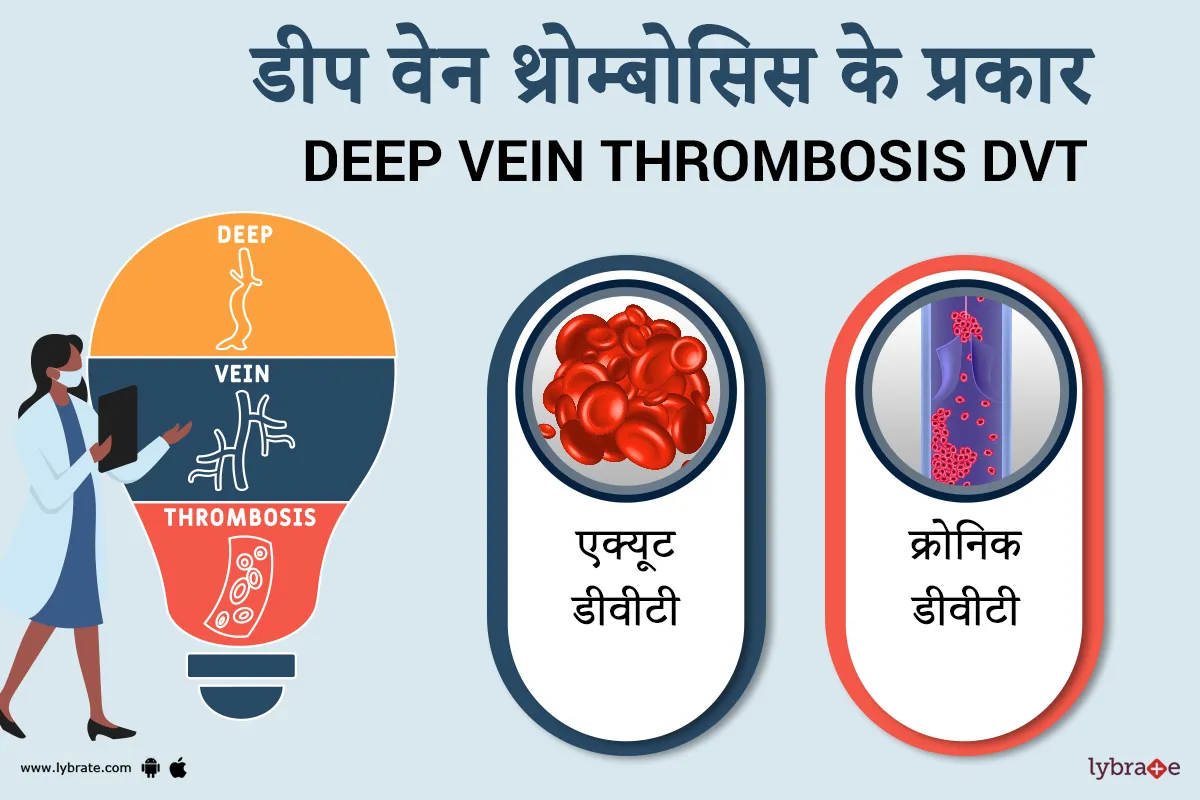 डीप वेन थ्रोम्बोसिस के प्रकार (deep vein thrombosis Ke Prakaar)
