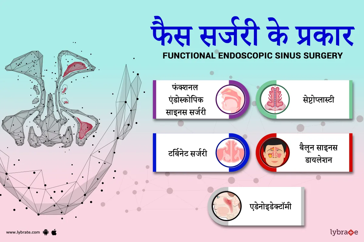 फैस सर्जरी के प्रकार - FESS Surgery ke prakar