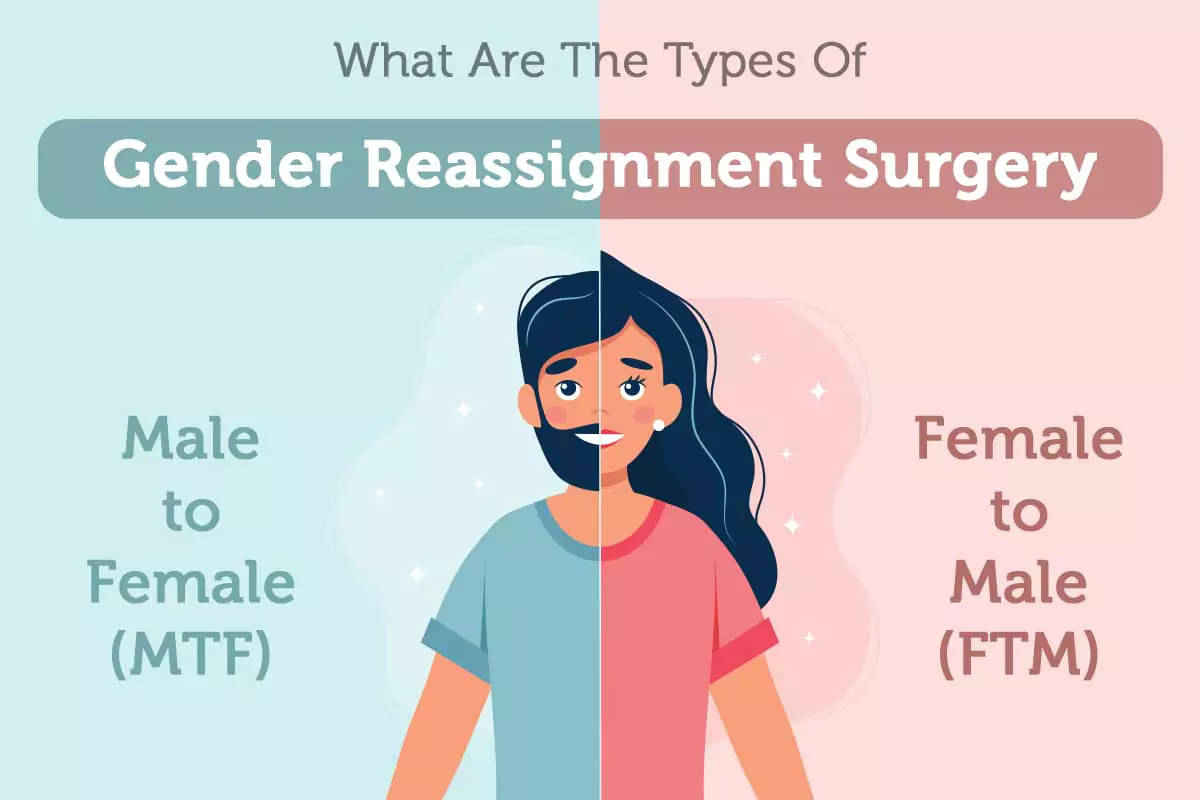 two types of gender reassignment surgery