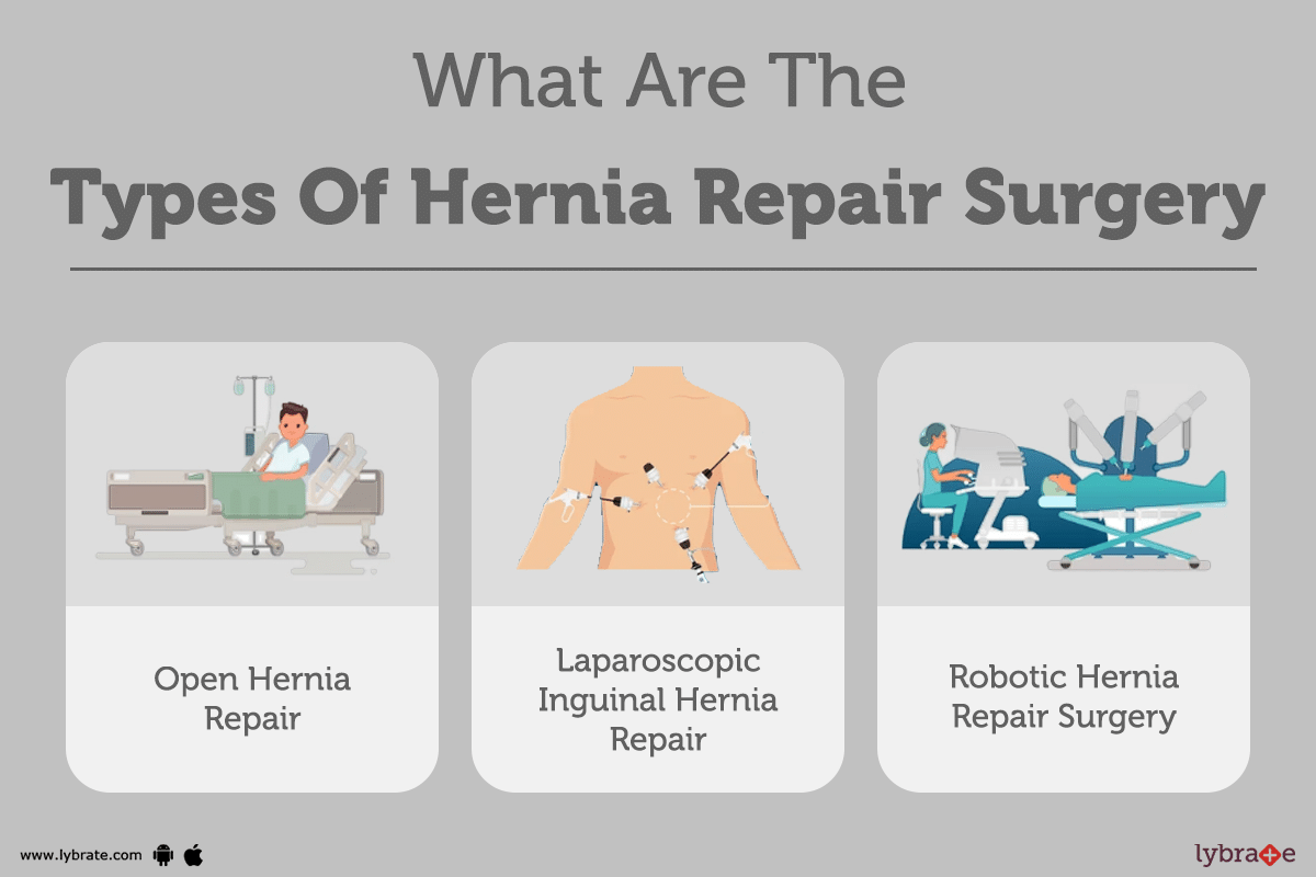 Hernia Surgery Purpose Procedure Benefits And Side Effects