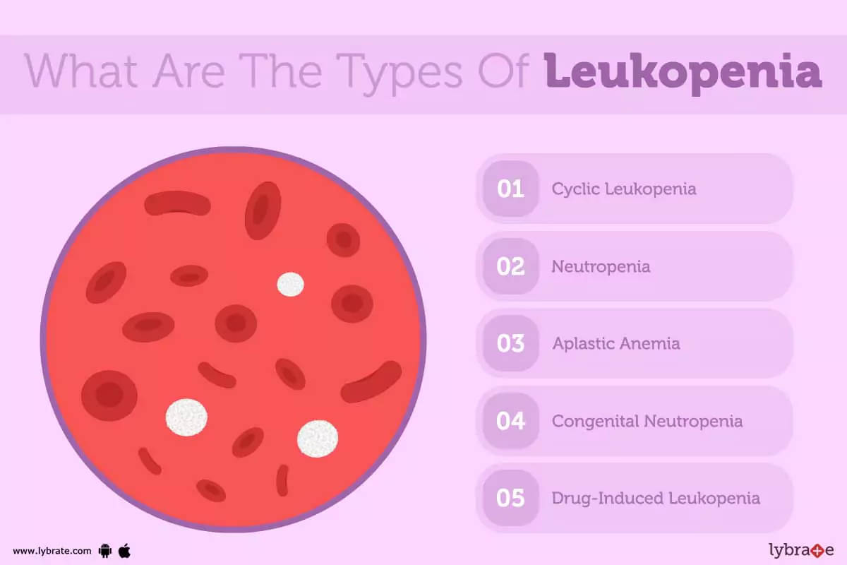 Leukopenia Causes Symptoms Treatment And Cost