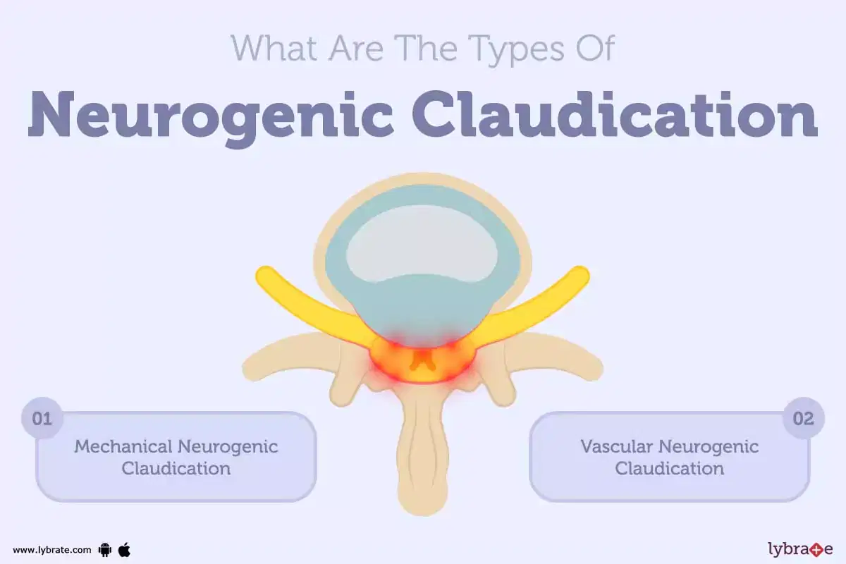 What Is Chronic Neurogenic Pain