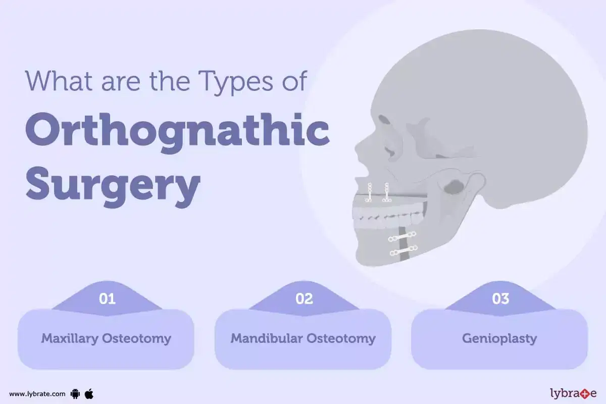 Topic Image