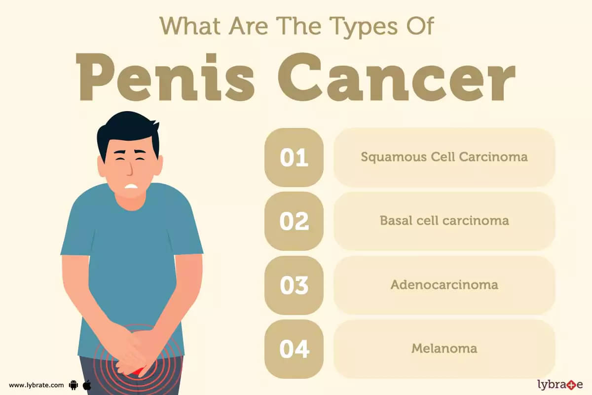 What Are The Types Of Penis Cancer 6483350229649.webp