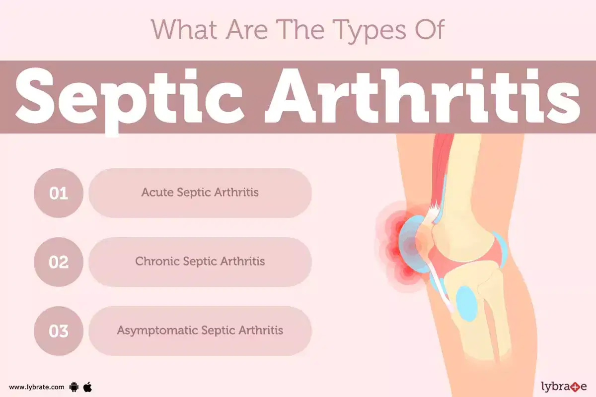 Arthritis: Causes, types, and treatments