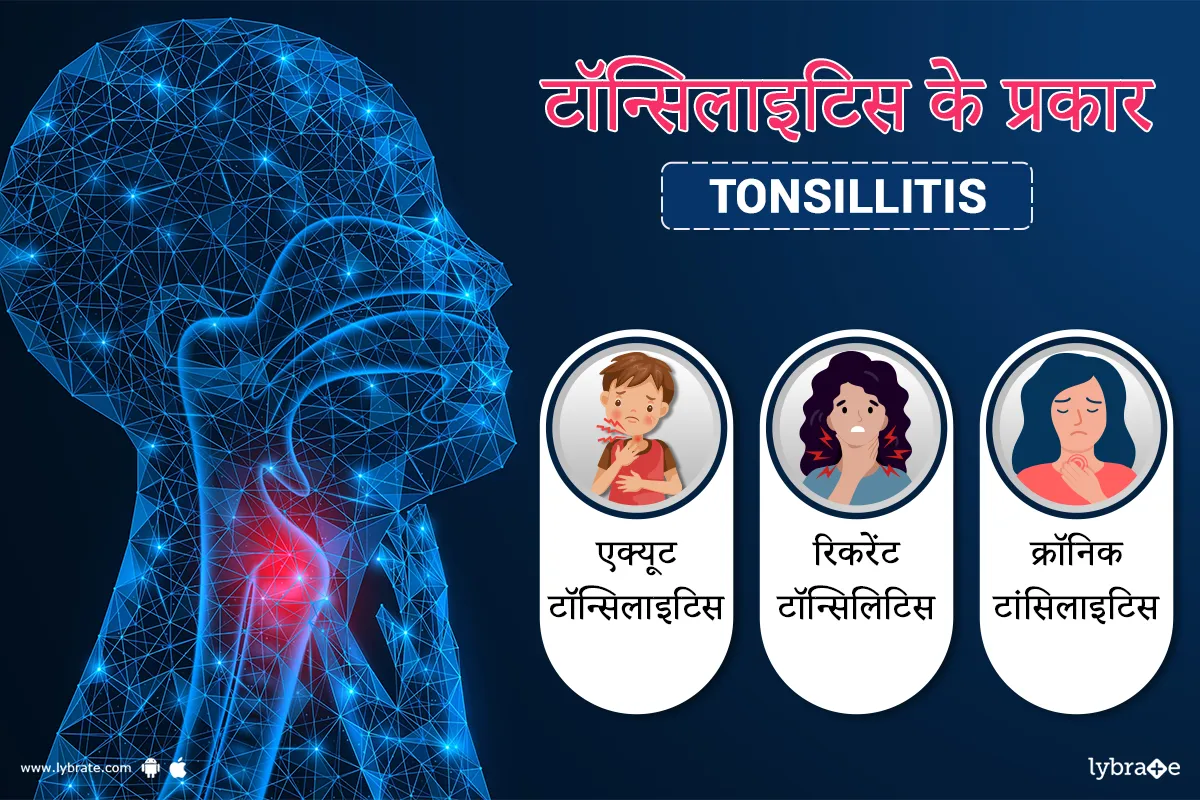 टॉन्सिलाइटिस के प्रकार (tonsils Ke Prakaar)
