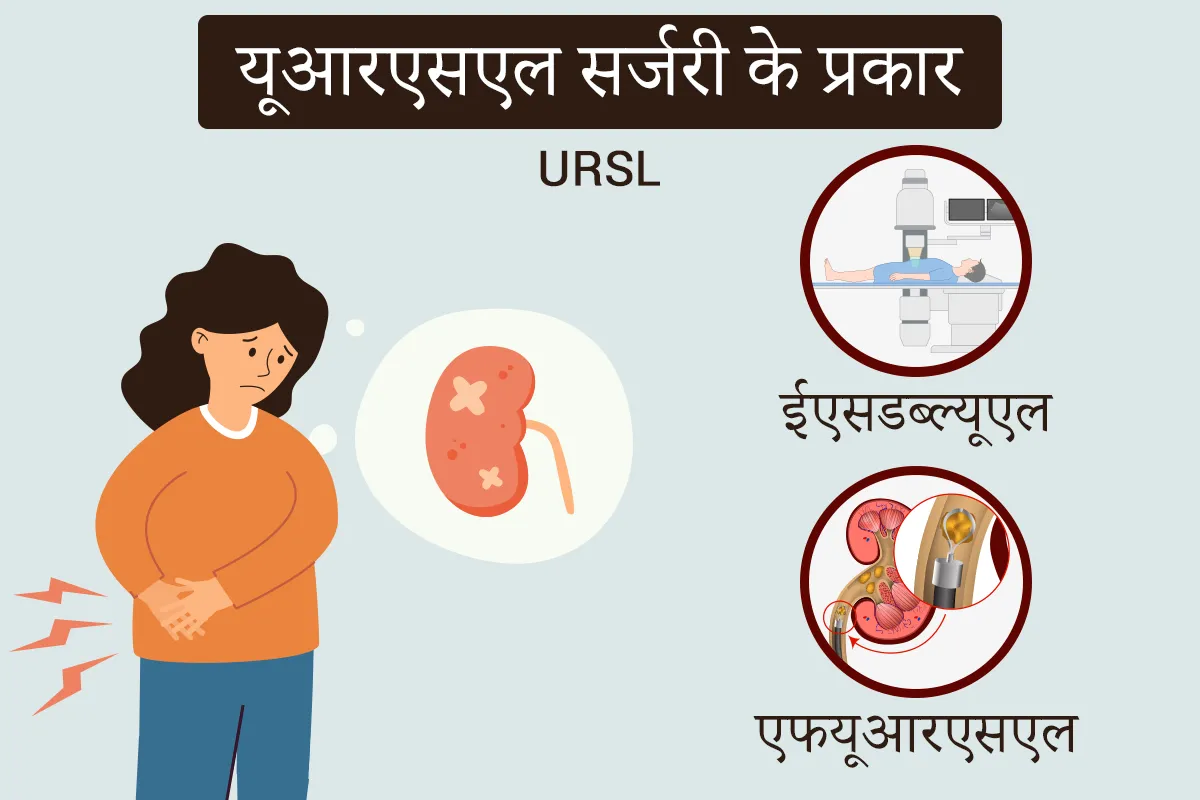 यूआरएसएल सर्जरी के प्रकार - URSL surgery ke prakar