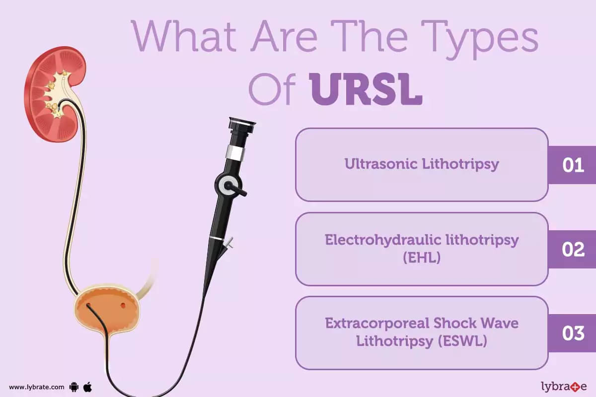 ureteroscopic lithotripsy