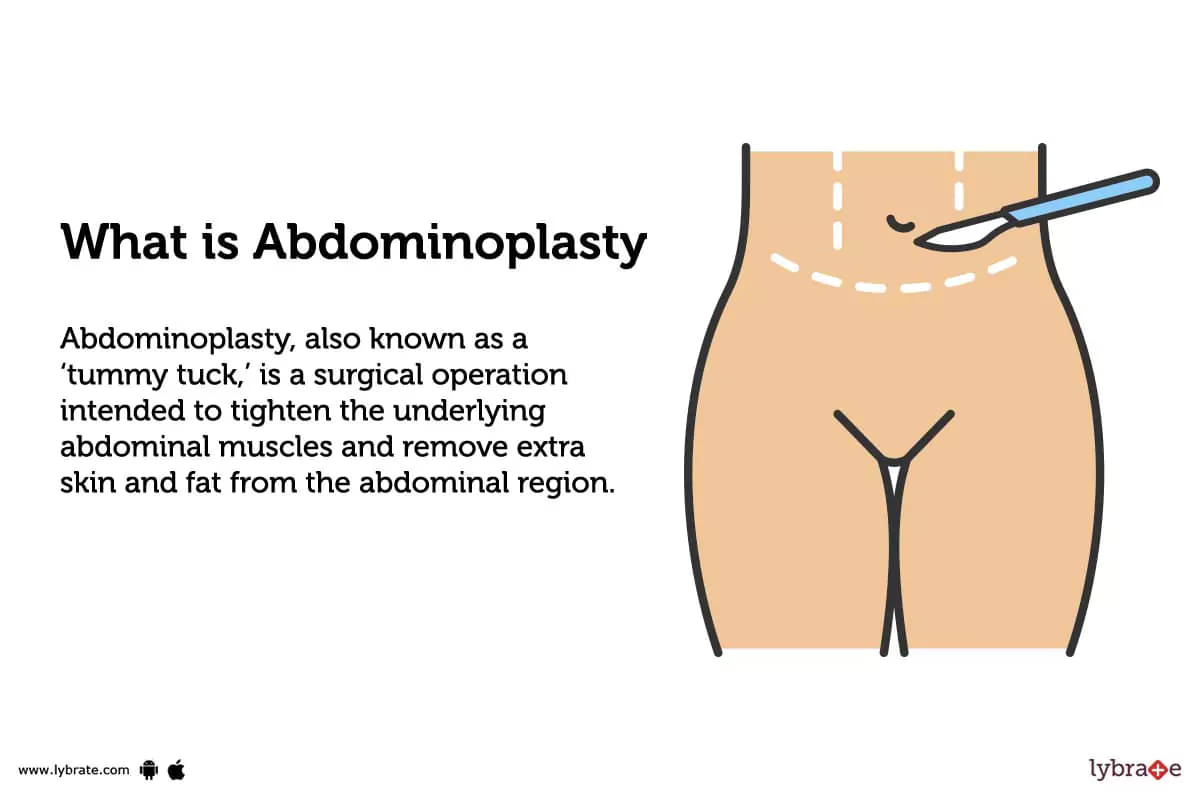 Will A Tummy Tuck Repair The Abdominal Muscles?
