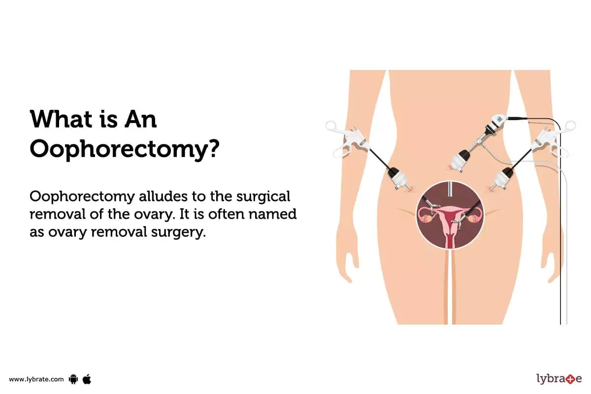 About Oophorectomy Abroad - Intclinics