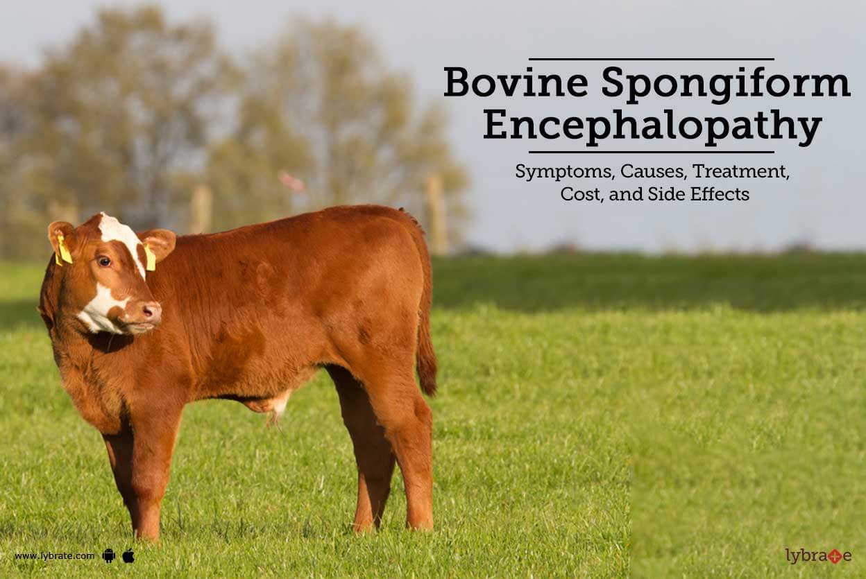 bovine-spongiform-encephalopathy-symptoms-causes-treatment-cost