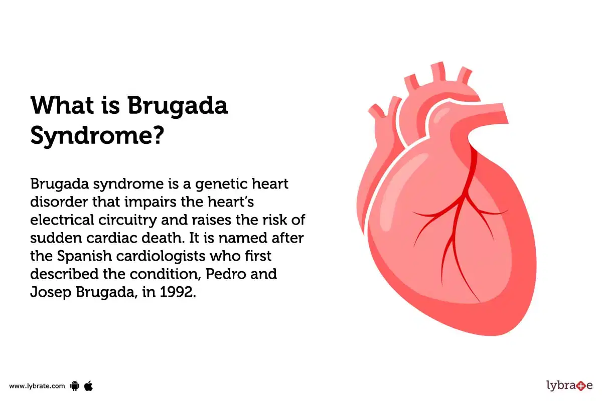 Joanne Bache Legshowjo - Brugada Syndrome: Treatment, Procedure, Cost, Recovery, Side Effects And  More