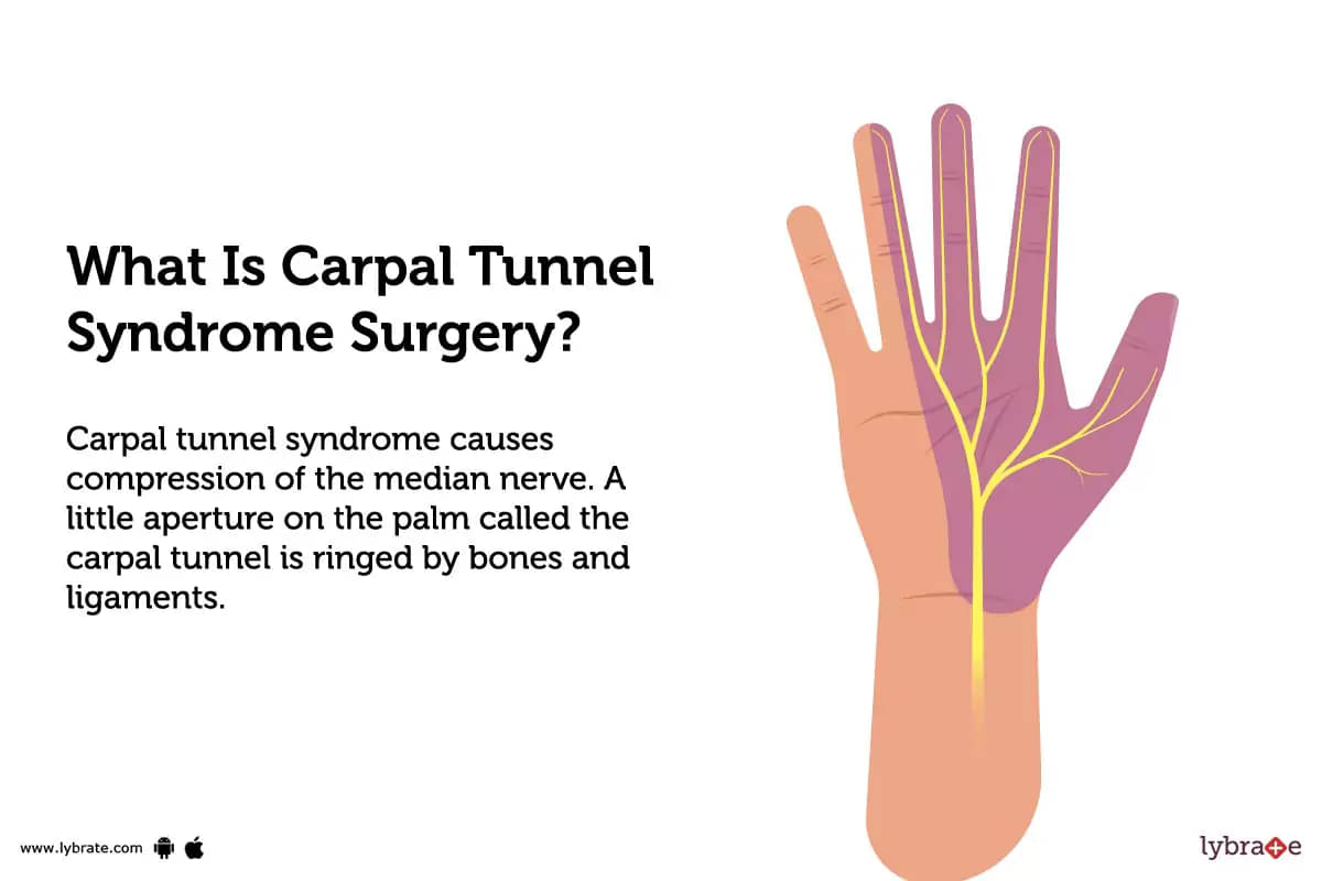 Carpal Tunnel Syndrome Surgery/Cure: Know Your Options Before Getting Carpal  Tunnel Surgery - The Orthopaedic Hand and Arm Center