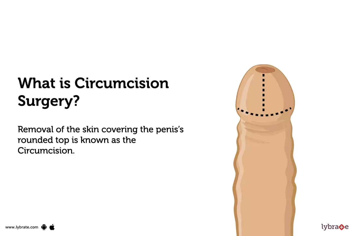 low circumcision