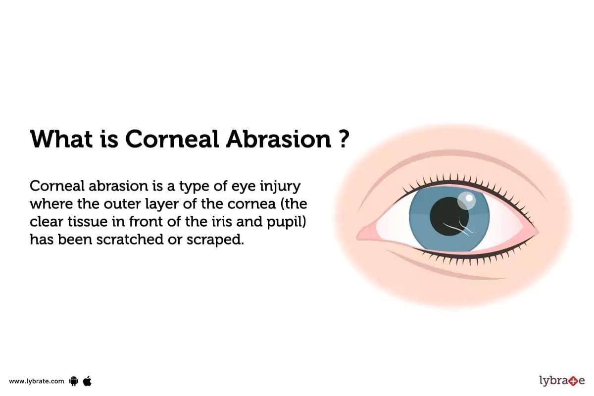 corneal scar treatment