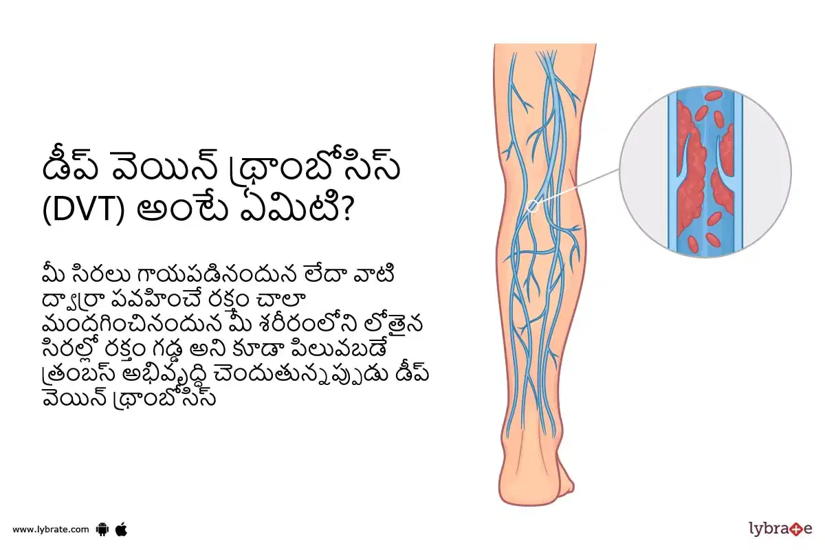 Topic Image
