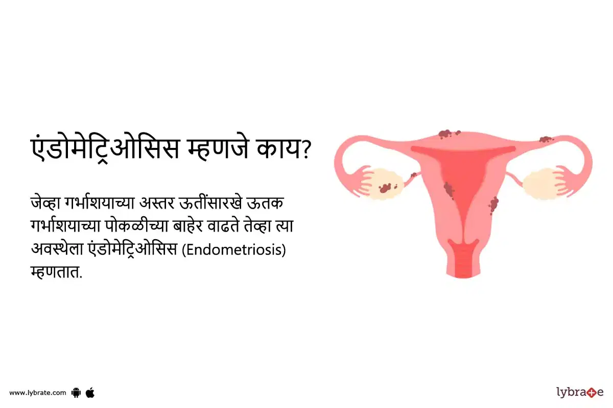 Topic Image
