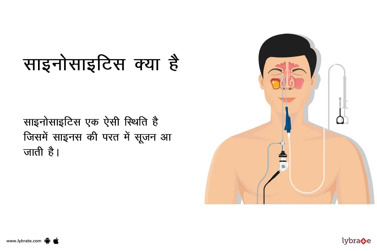 साइनस सर्जरी: प्रकार, कारण, प्रक्रिया, लागत, और क्या यह सुरक्षित है?