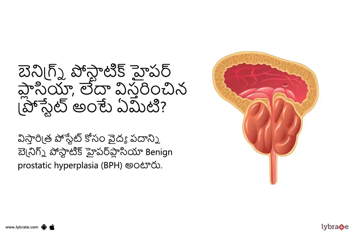 Topic Image