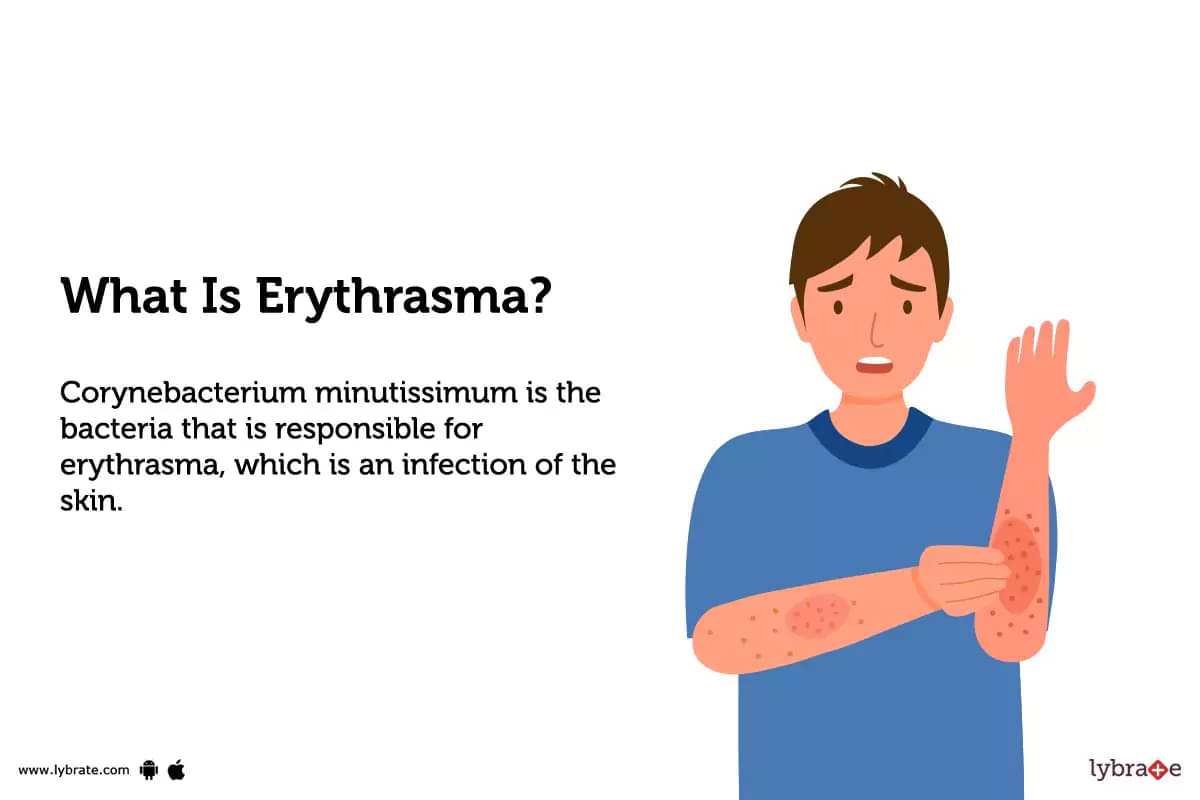 Erythrasma: Causes, Symptoms, Treatment and Cost
