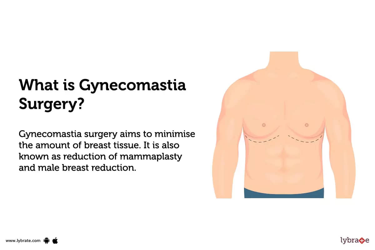 Gynecomastia Surgery: Purpose, Procedure, Benefits and Side Effects