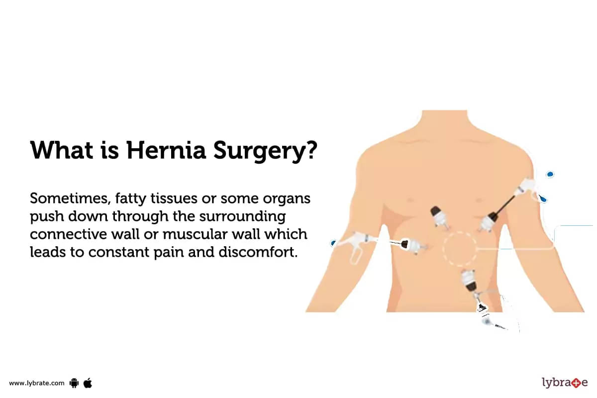 About Hernias, Hernia Surgery