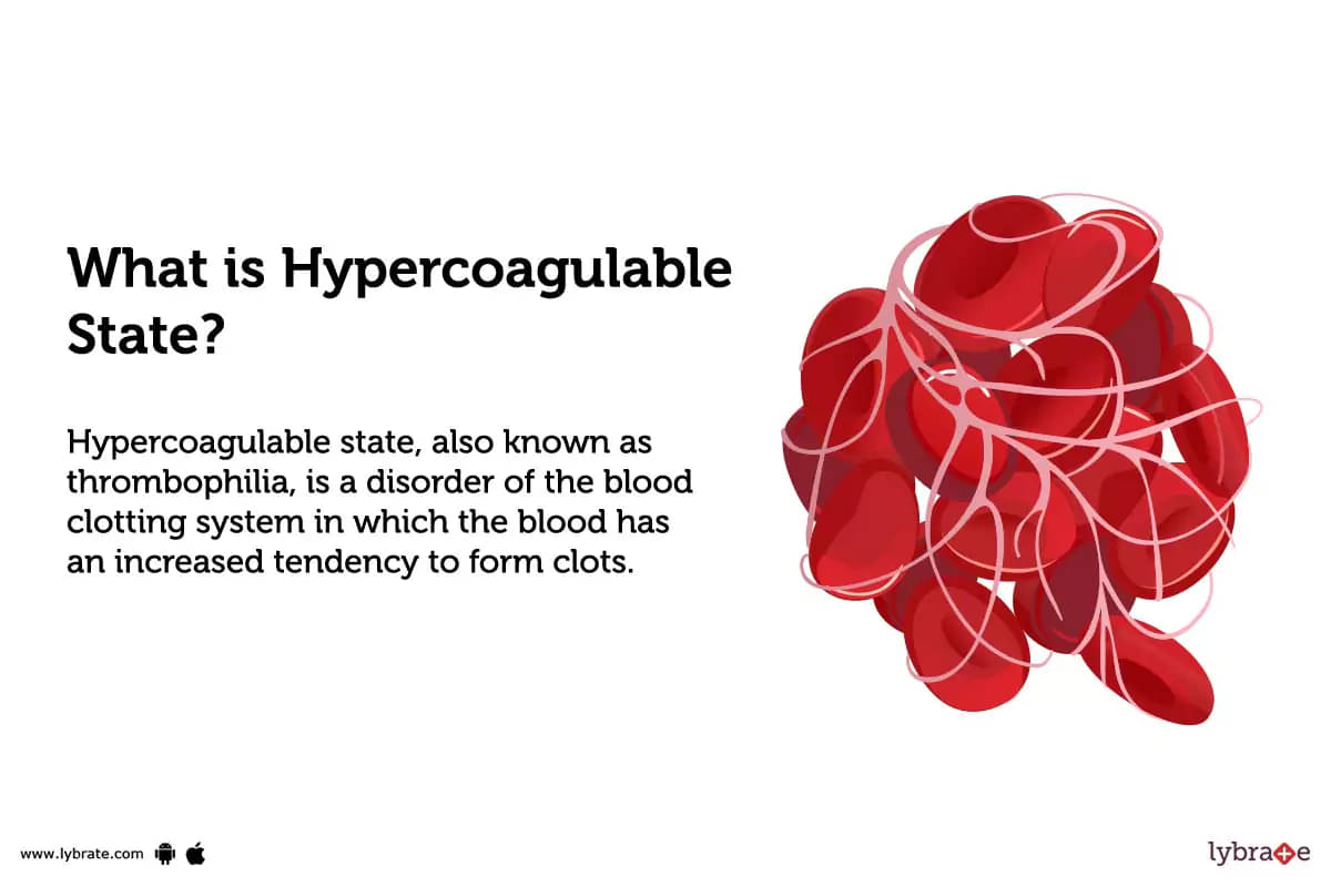 Hypercoagulable state: Causes, Symptoms, Treatment and Cost