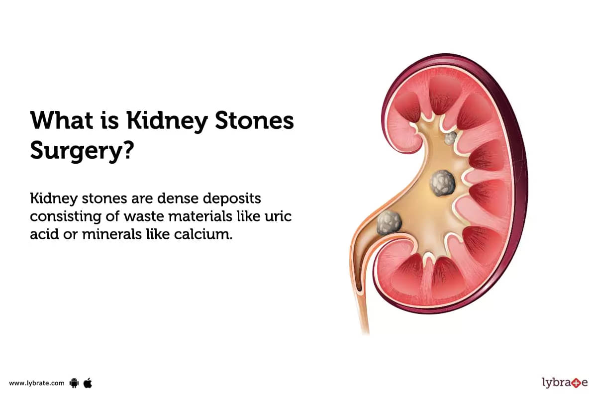 Phimosis - Cure Stone - Urology, Andrology, Renal Transplant