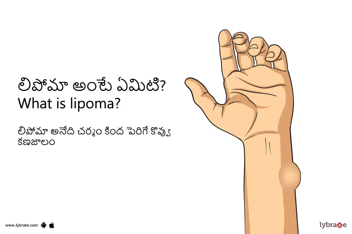 Topic Image