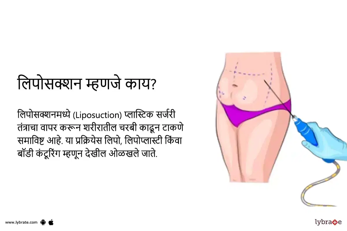 Topic Image