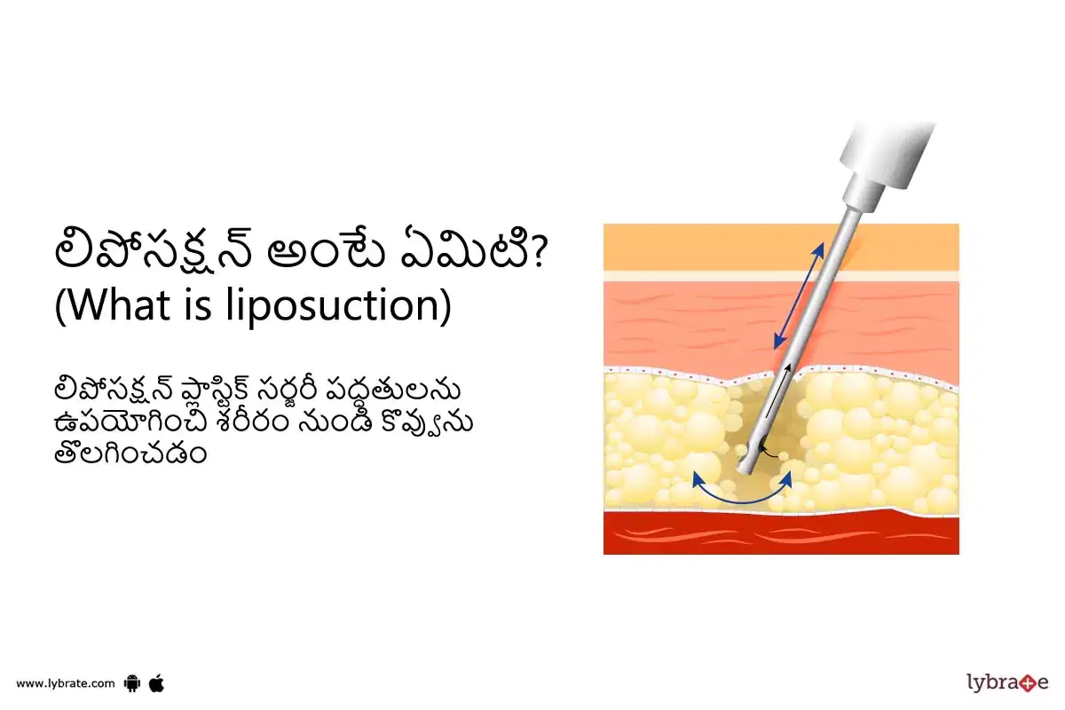 Topic Image