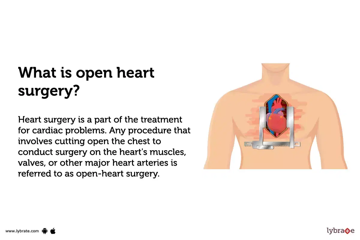 Cardiothoracic Surgery: Prep, Recovery, Long-Term Care