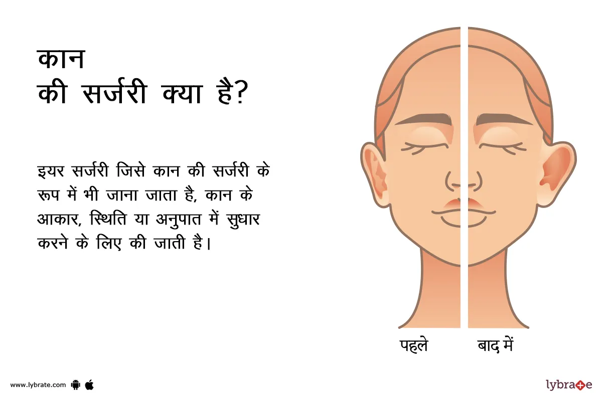 कान की सर्जरी क्या है - What is Ear Surgery in Hindi