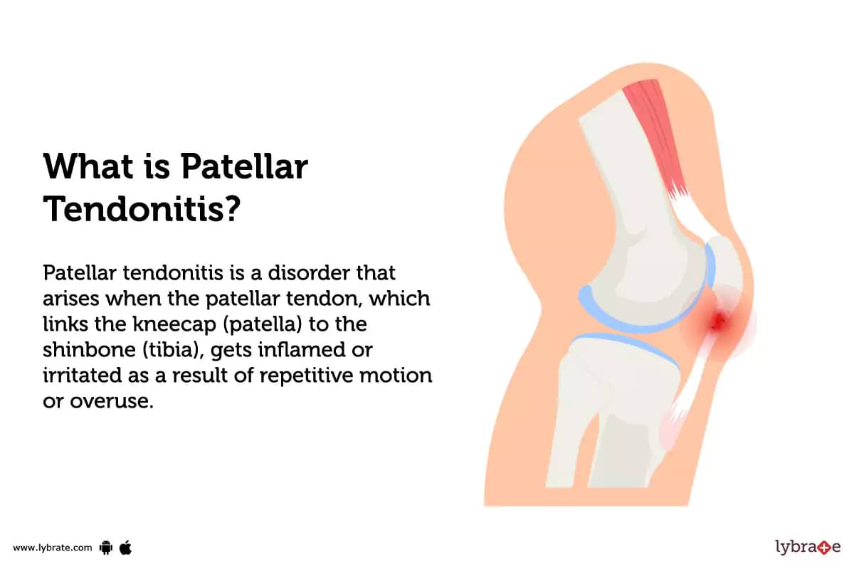 https://assets.lybrate.com/imgs/tic/enadp/what-is-patellar-tendonitis.webp
