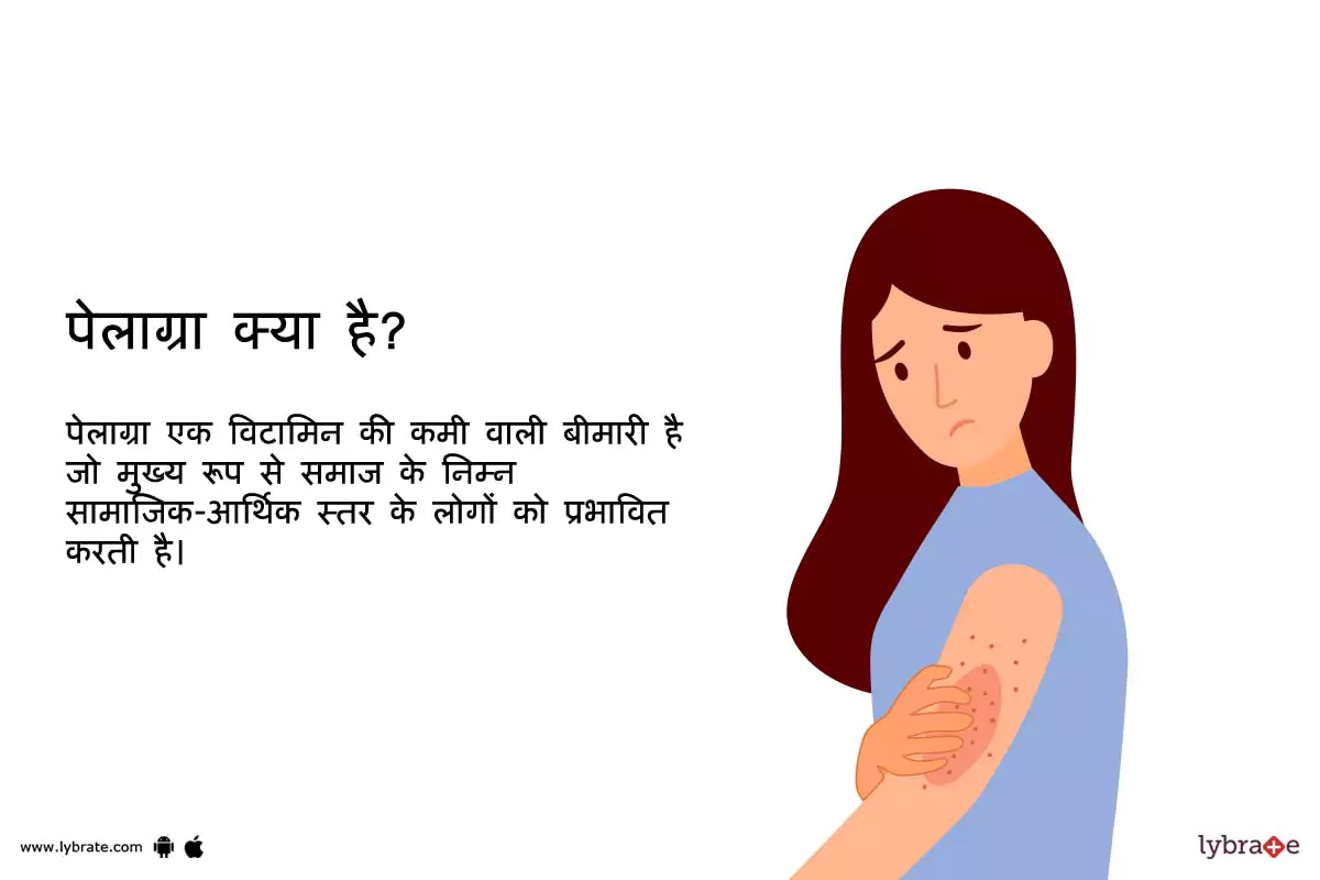 पेलाग्रा क्या है?
