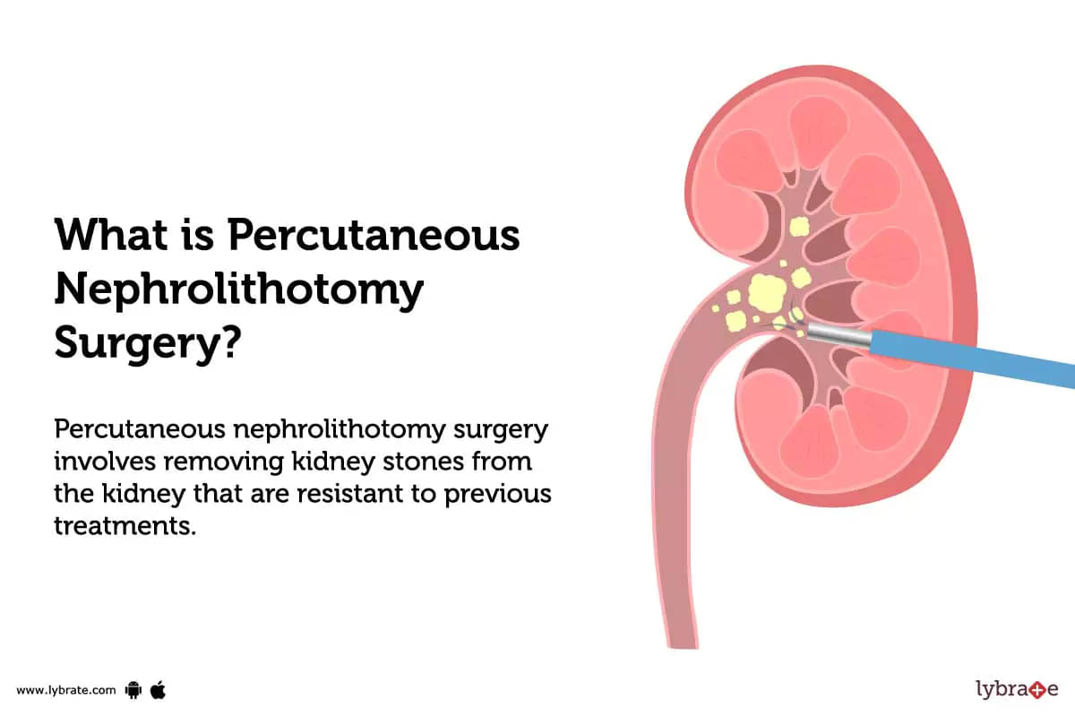 what is percutaneous nephrolithotomy surgery