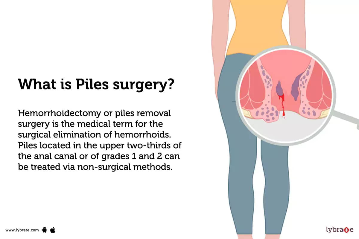 Surgical treatment of Piles / Hemorrhoids