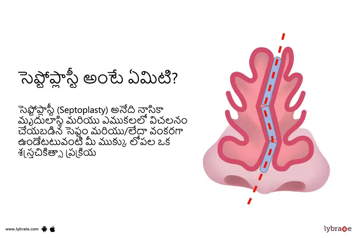 Topic Image