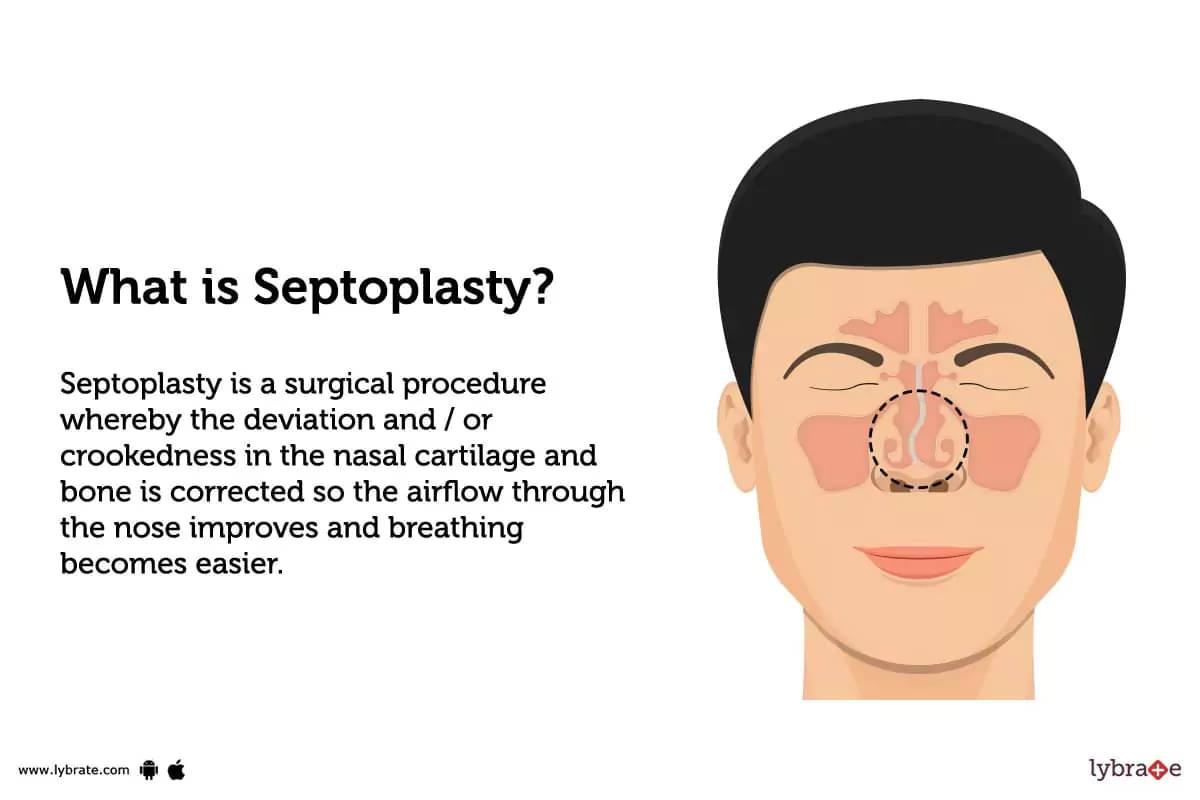 Septoplasty: Breathing Before, Swelling After, Results