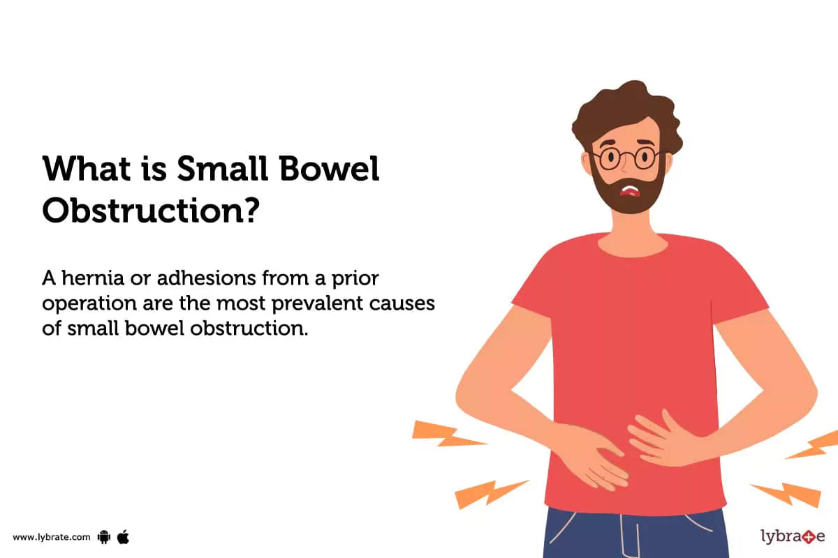 What Is Small Bowel Obstruction.webp