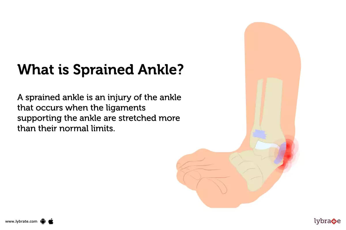 Ankle Sprain –