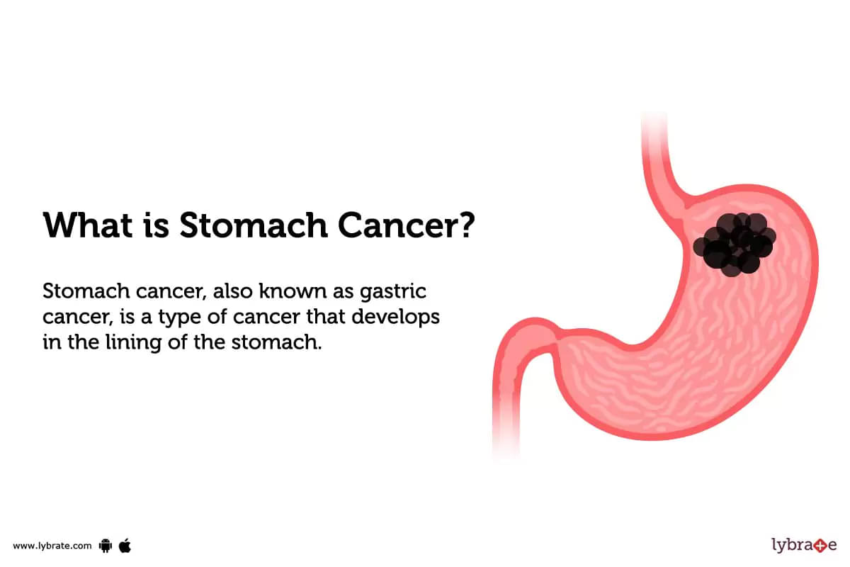 stomach definition