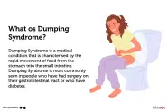 Dumping Syndrome Causes Symptoms Treatment And Cost