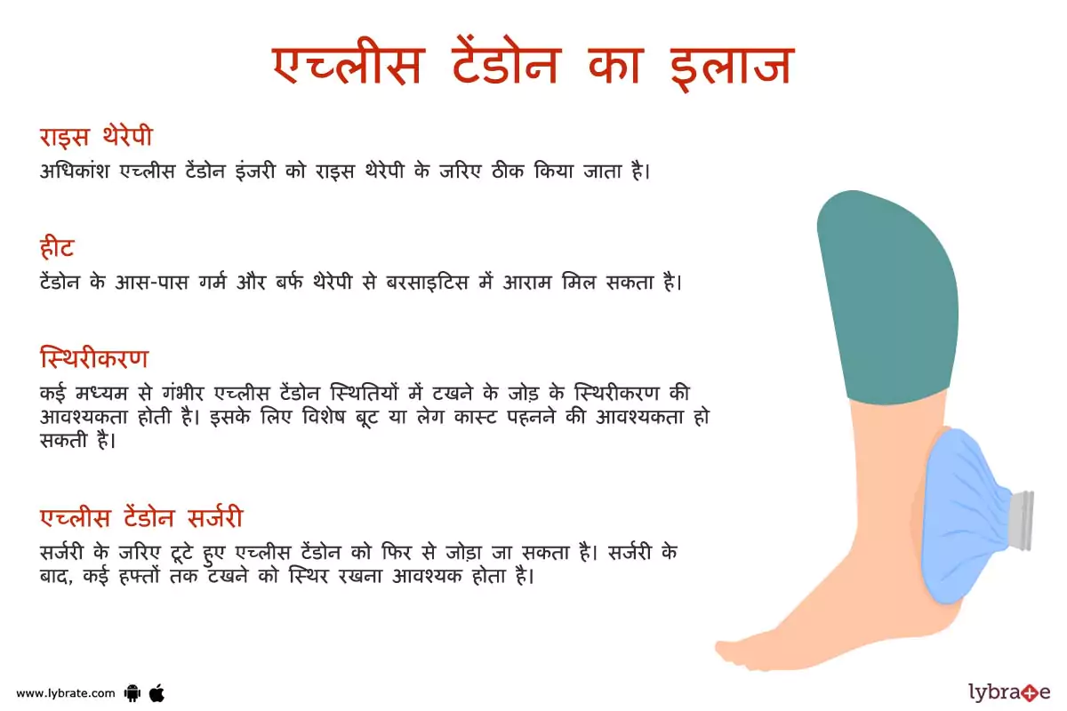 अकिलिस टेंडन का इलाज | Achilles Tendon Ki Bimariyon Ke Ilaaj