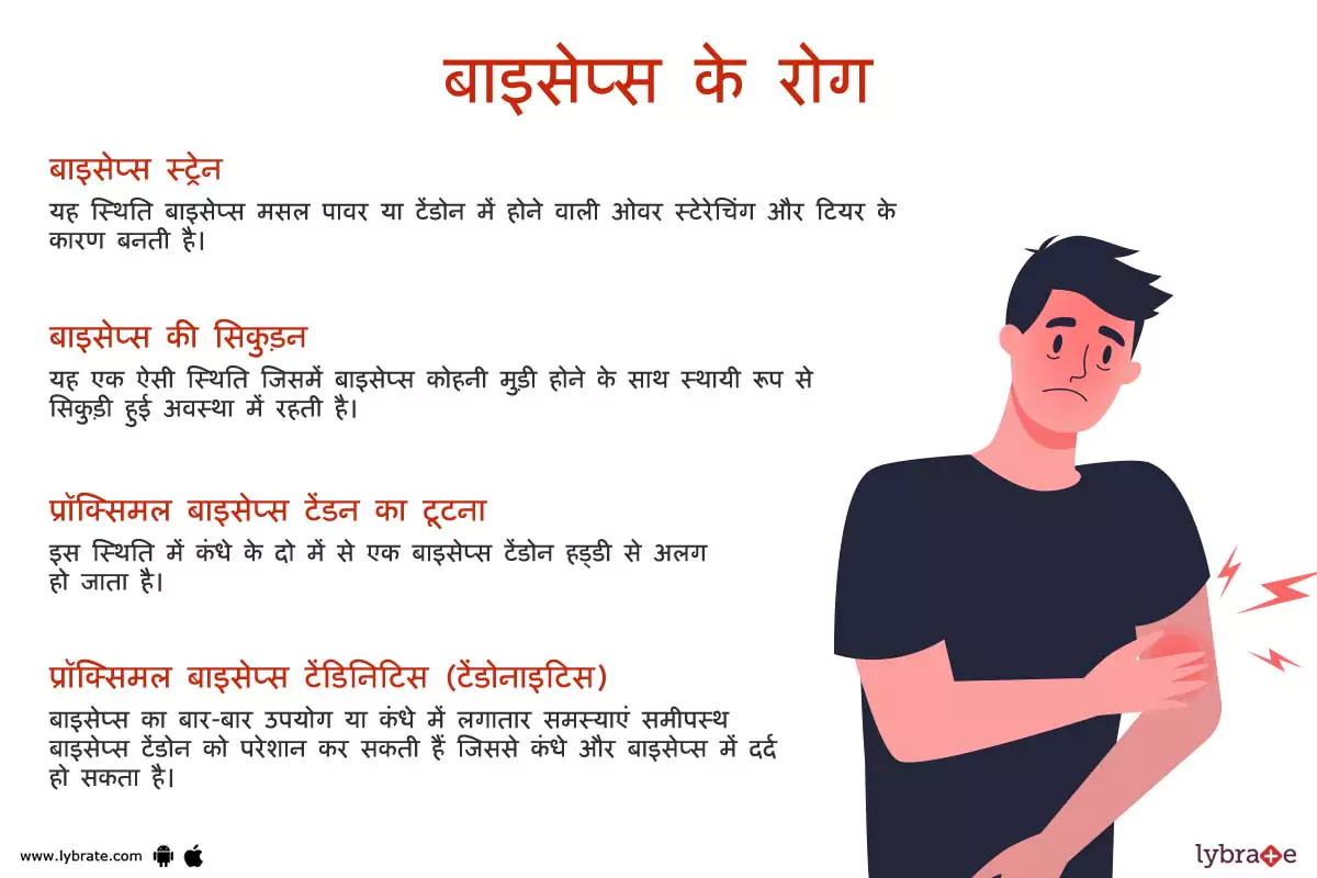 बाइसेप्स के रोग | Biceps Ki Bimariya